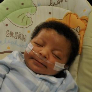 A baby with a cannula in his nose sleeps.