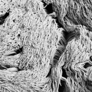 healthy lung cilia in cell culture