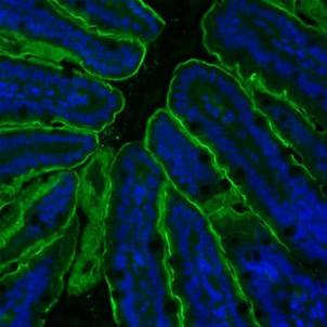 CHLA-Kohli-Figure 2 - Apical Sodium Bile acid Transporter (ASBT) staining of the terminal ileum sections with ASBT antibody (green fluorescence)..jpg