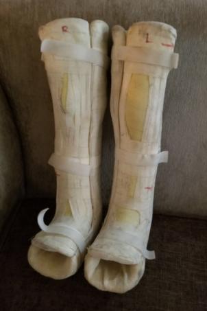 chla-miguel-torres-cast-patient-story-neuro-.jpg